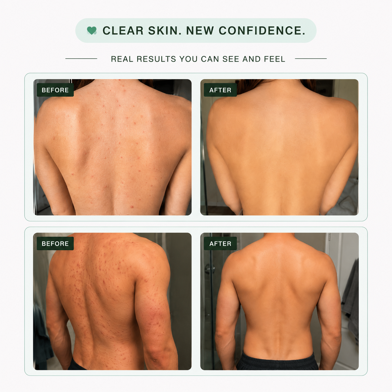 Miracle Acne Clear Body Cleanser